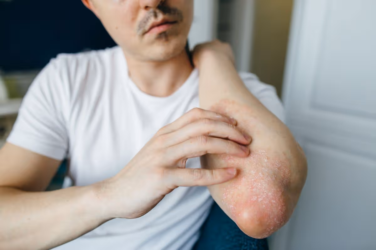 Skin Conditions care with a Lyla Health clinician